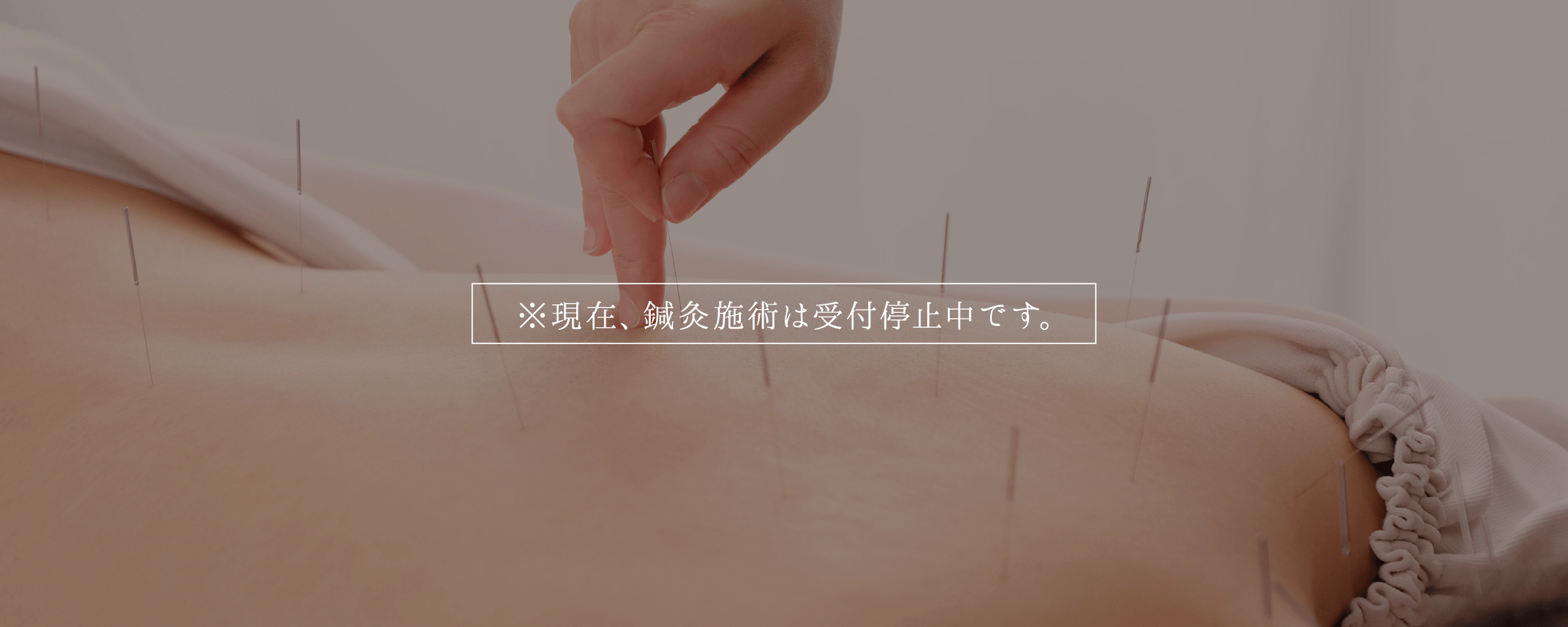 鍼灸施術イメージ