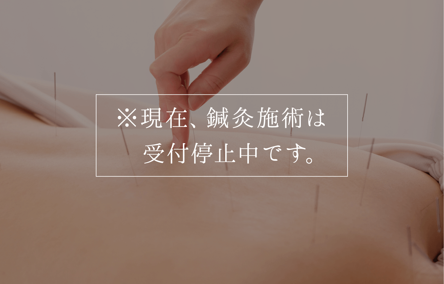 鍼灸施術イメージ